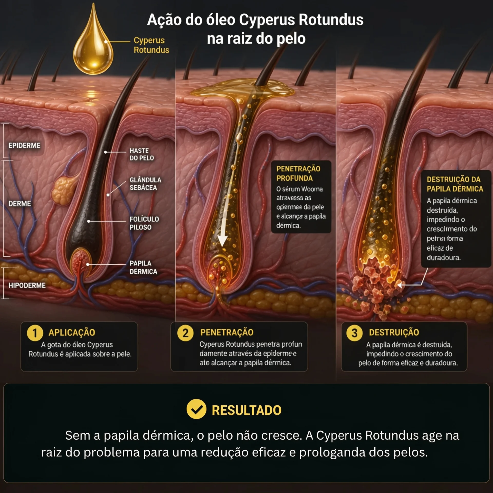 Ação do óleo Cyperus Rotundus na raiz do pelo